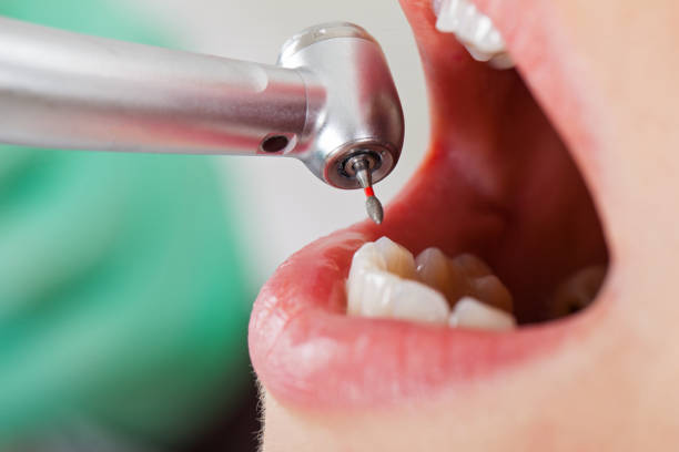 Best Weekend Emergency Dentist in Winona, MN